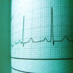 Pentingnya Alat Deteksi Gempa untuk Meningkatkan Kesiapsiagaan