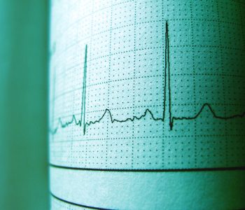 Pentingnya alat deteksi gempa