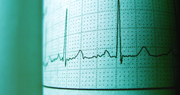Pentingnya alat deteksi gempa